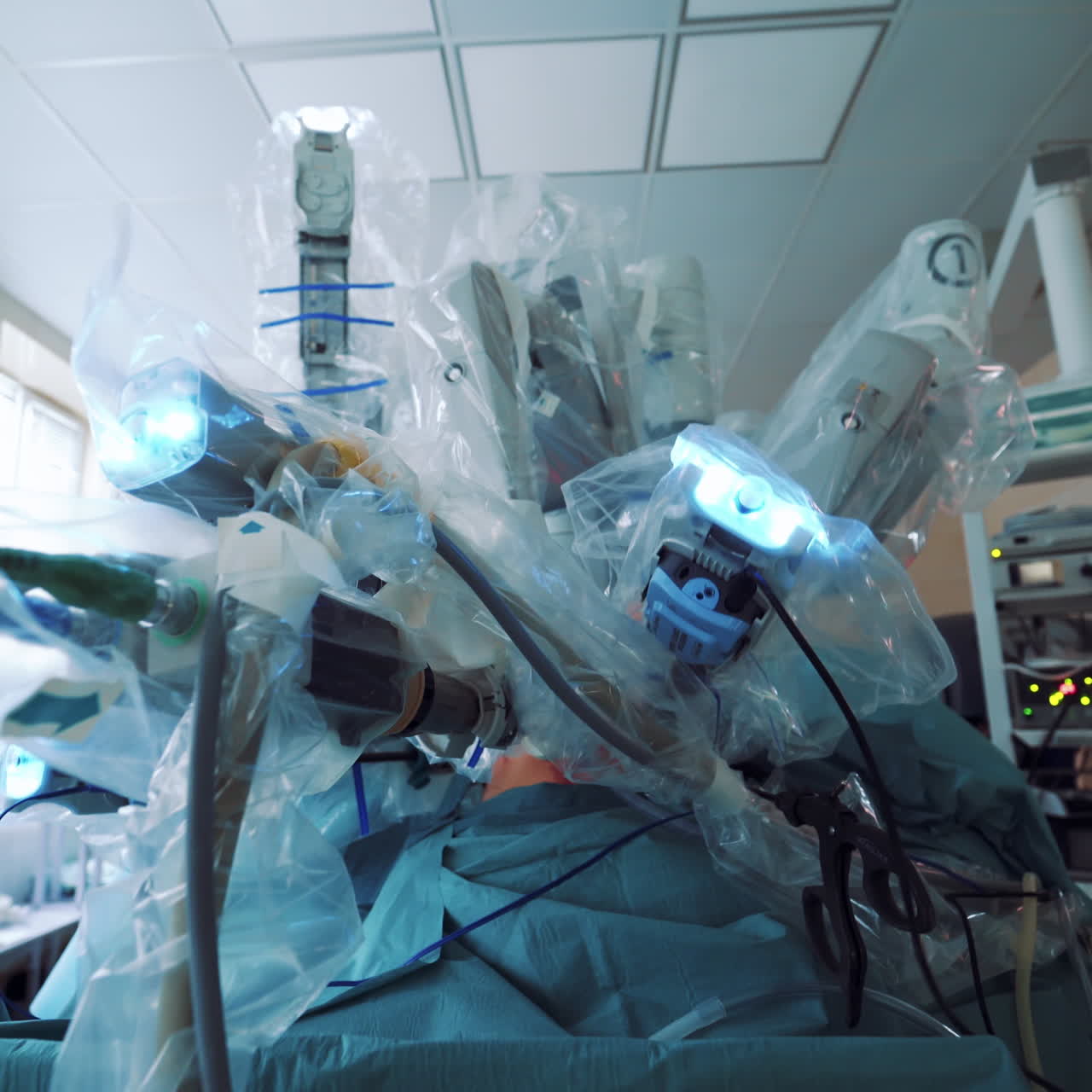 Medical operation involving robot. Medical robot. Robotic Surgery.