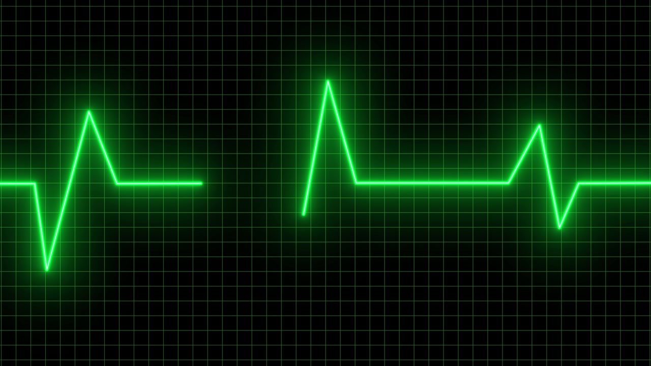 Linha Verde de Monitor de Batimento Cardíaco EKG em Fundo Quadriculado