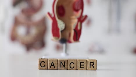 cancer word on blocks with anatomical model
