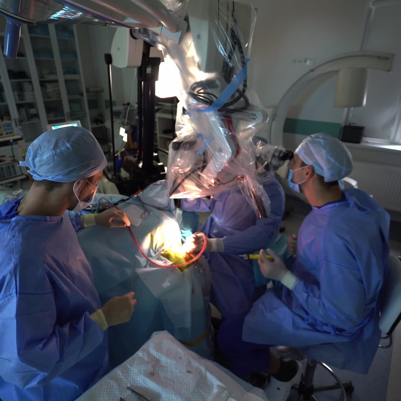 Neurosurgery professionals carrying out the operation. Intense work of the surgeons applying high-precise microscope. View from above