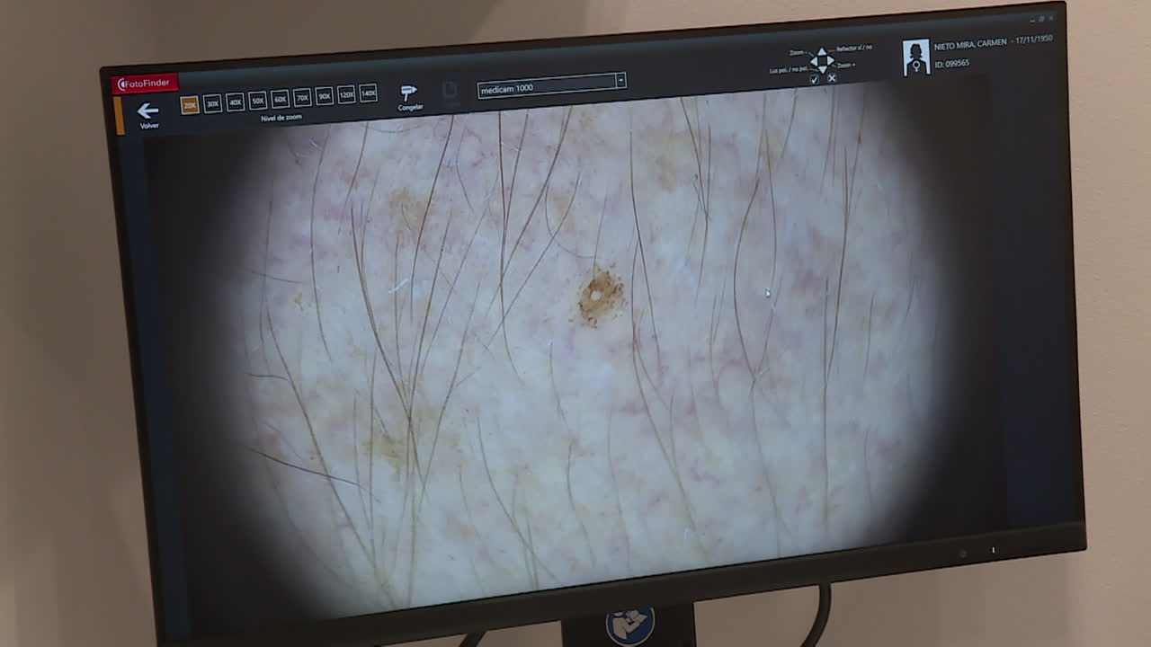 Dermoscopic Images of Skin Lesions