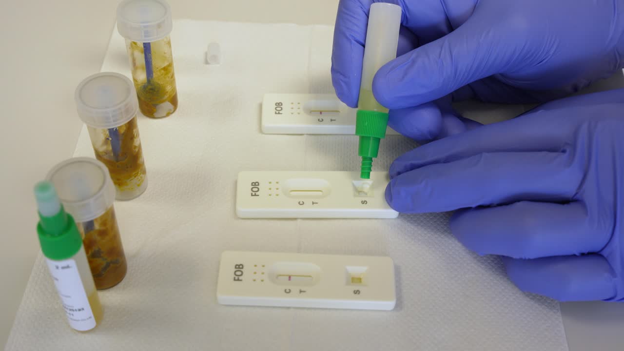 Twisting off the test tube to drip human stool sample onto rapid test cassette for testing in fecal occult blood in laboratory