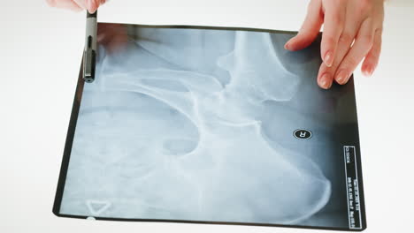 medical professional examining an x-ray film