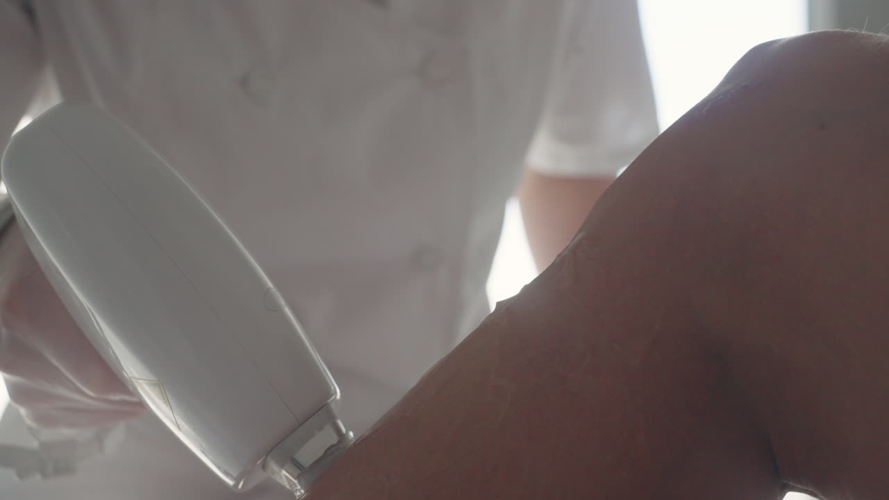 미용 클리닉 에서 머리카락 을 제거 하기 위한 현대적 인 레이저 장치