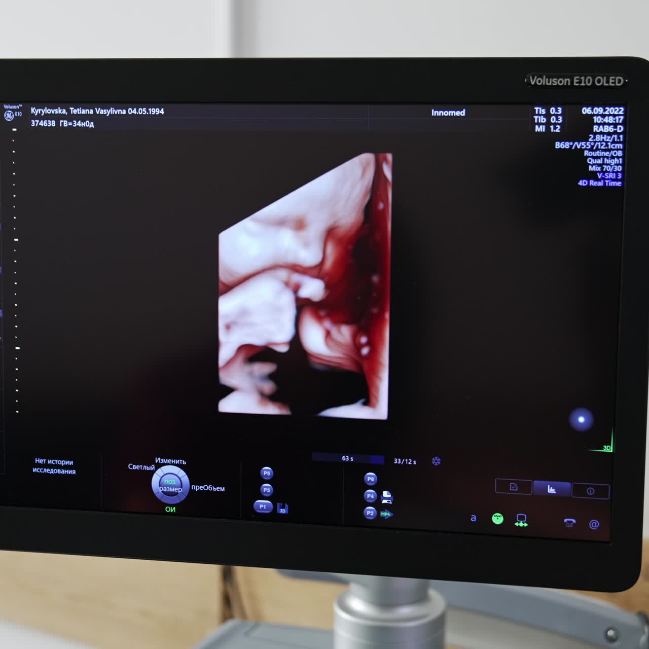 3d image of a baby in the mother's womb. Cute child's head and little hands on the black screen of ultrasonic equipment. Close up