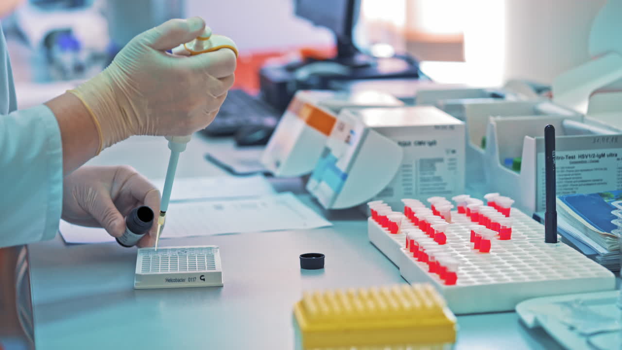 Laboratory technician is filling rack with special liquid from the small plastic jar on the table. Medical tests. Clinical diagnostic laboratory equipment.