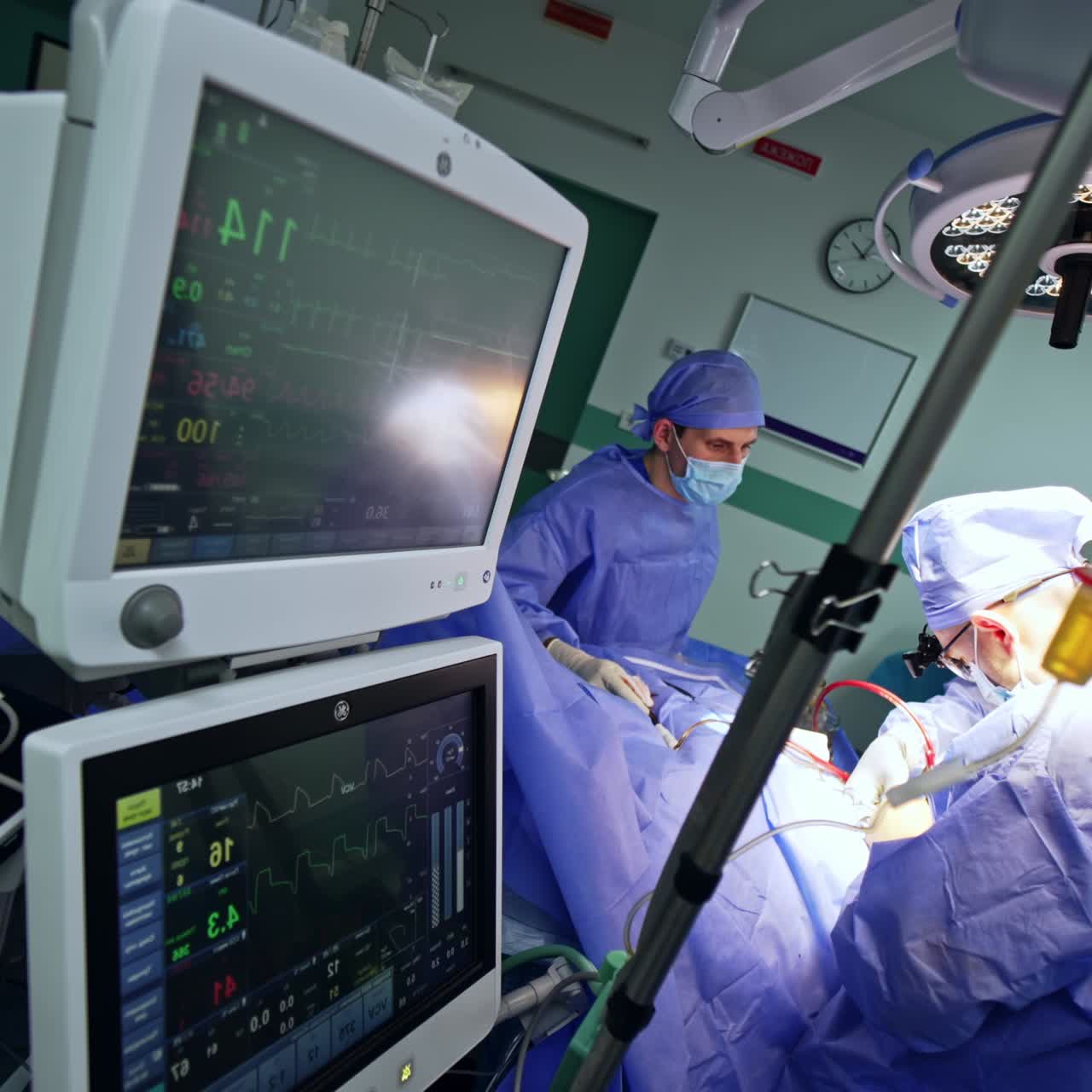 Monitors of the machine for artificial lung ventilation. Switched on screens with patient's life signs. Surgery at backdrop