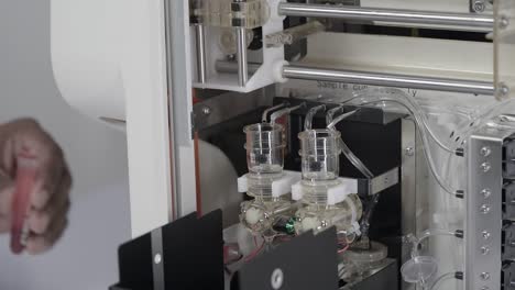 hand putting blood sample into blood cbc machine