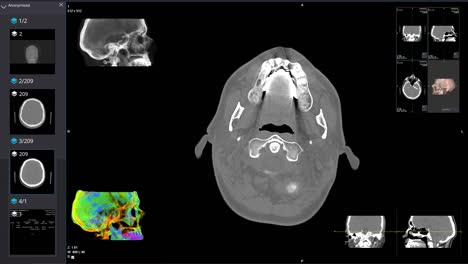 computed tomography of the head.