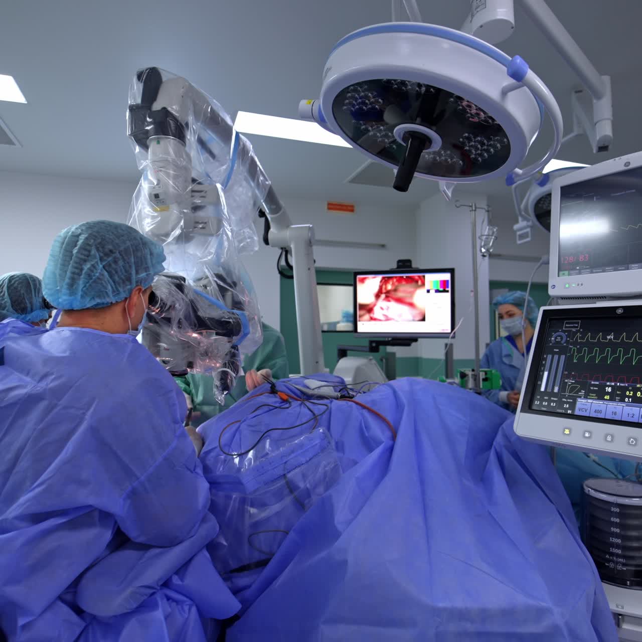 Neurosurgery specialist conducts operation assisted by a nurse. Powerful microscope is used by the doctor. Diverse equipment working in the modern operational room