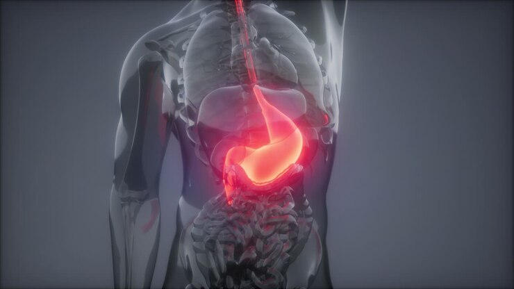 Human Stomach Radiology Exam