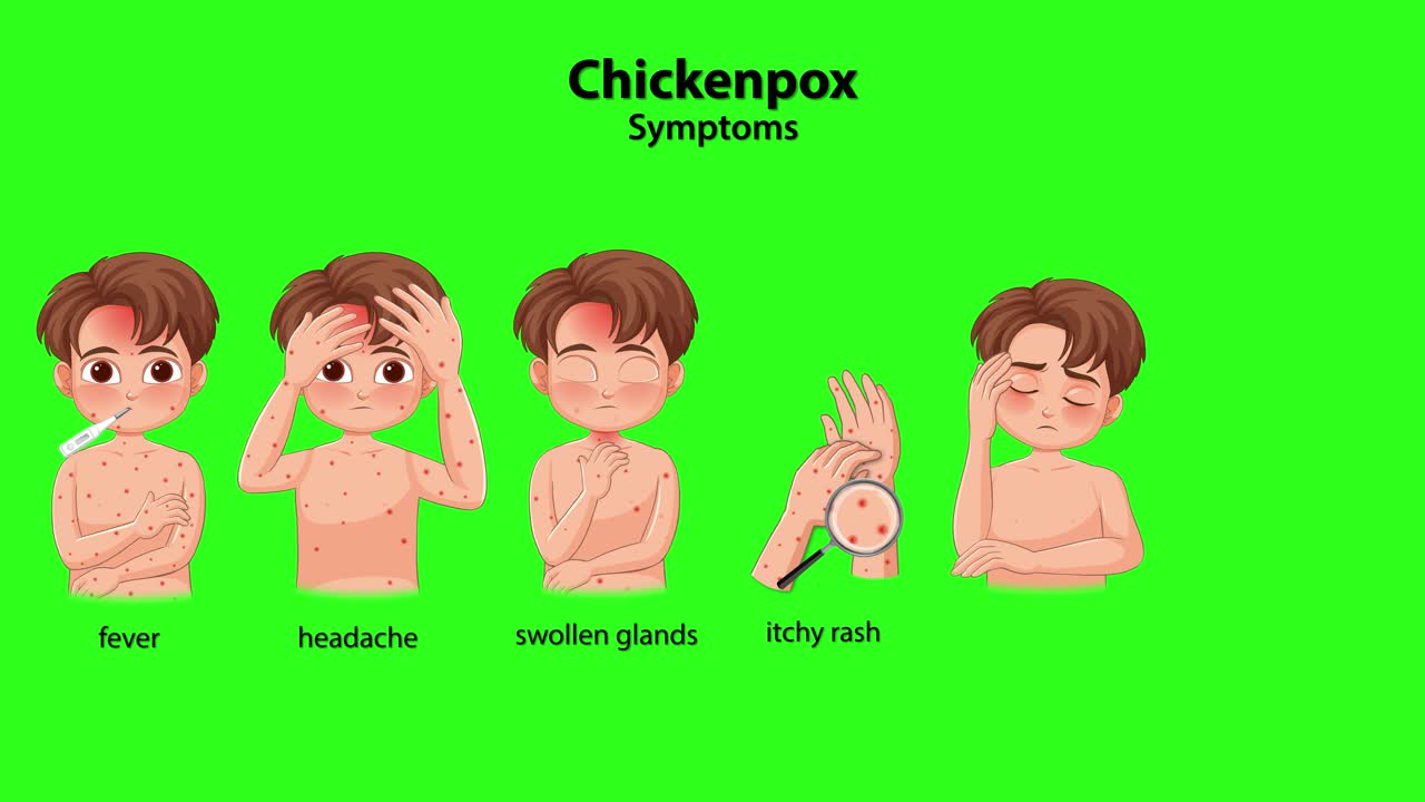 Cartoon boy illustrates chickenpox symptoms progression with labeled icons, green background, smooth transitions, educational style