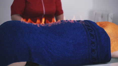 massage therapist burns flame on patient back in clinic