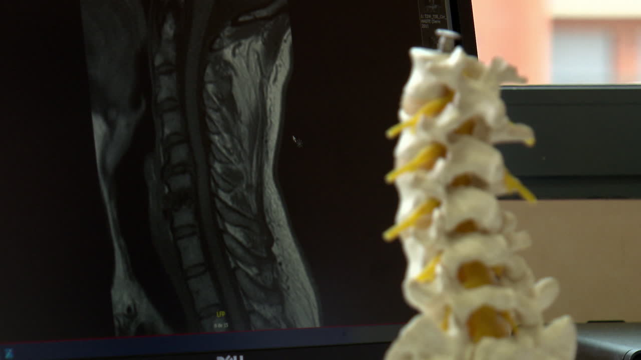 Spine MRI and Model