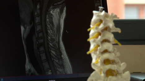 spine mri and model