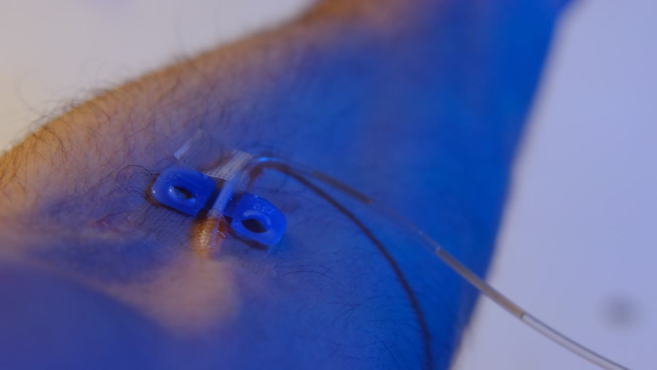 brazo de transfusión de sangre